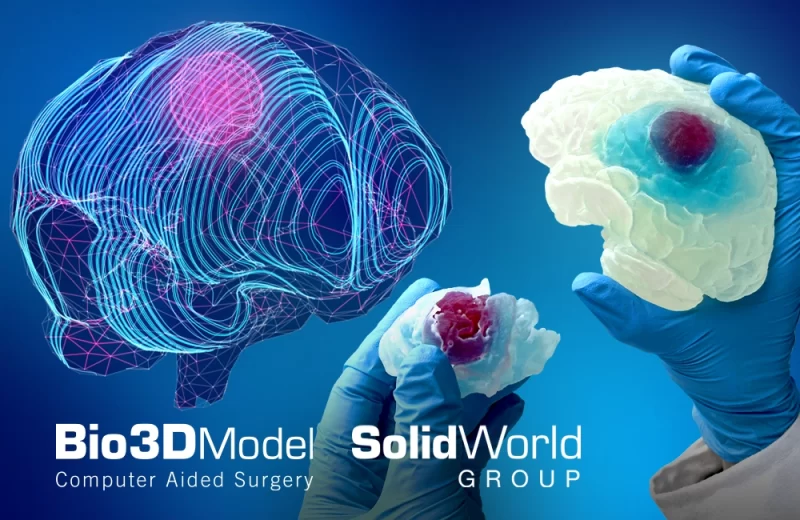 Tecnologia 3D, Solidworld GROUP riproduce in 3D un cervello umano affetto da tumore